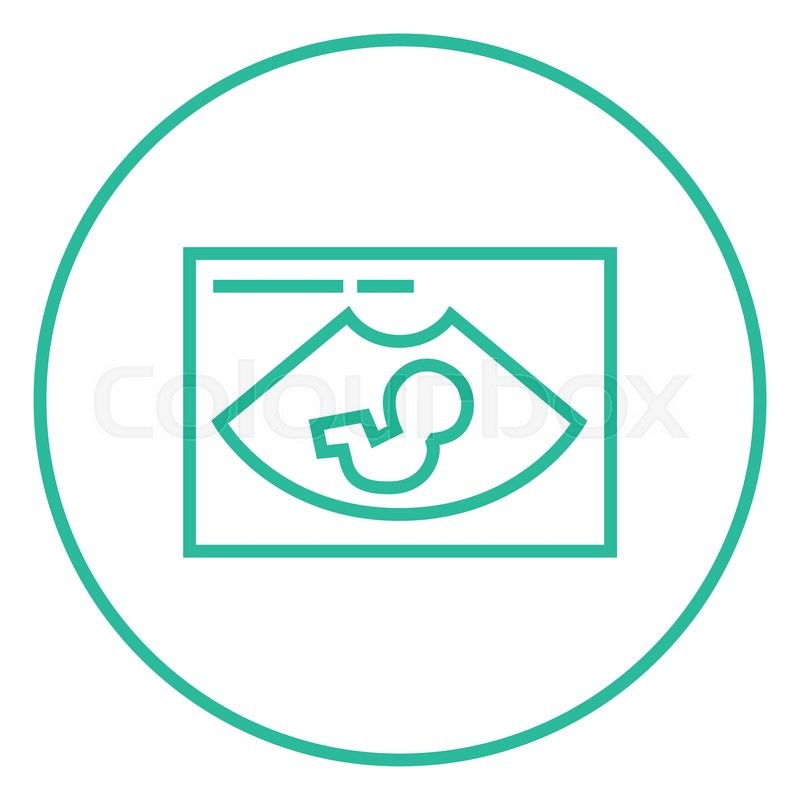 800x800 Fetal Ultrasound Thick Line Icon With Stock Vector Colourbox