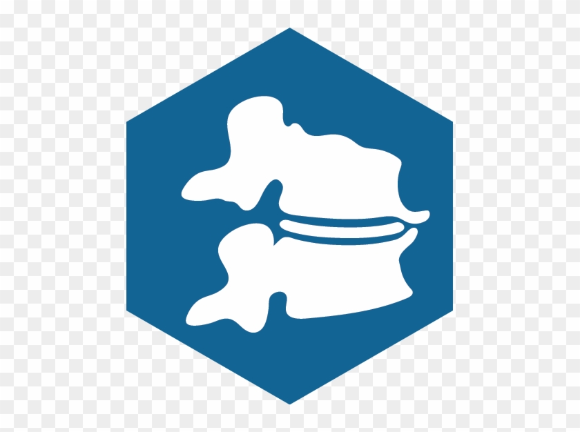 840x626 Spinal Bone Spurs