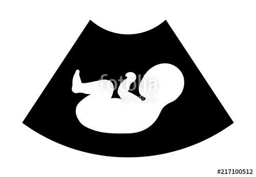 500x346 Baby Ultrasound, Diagnostic Sonography Or Ultrasonography Imaging